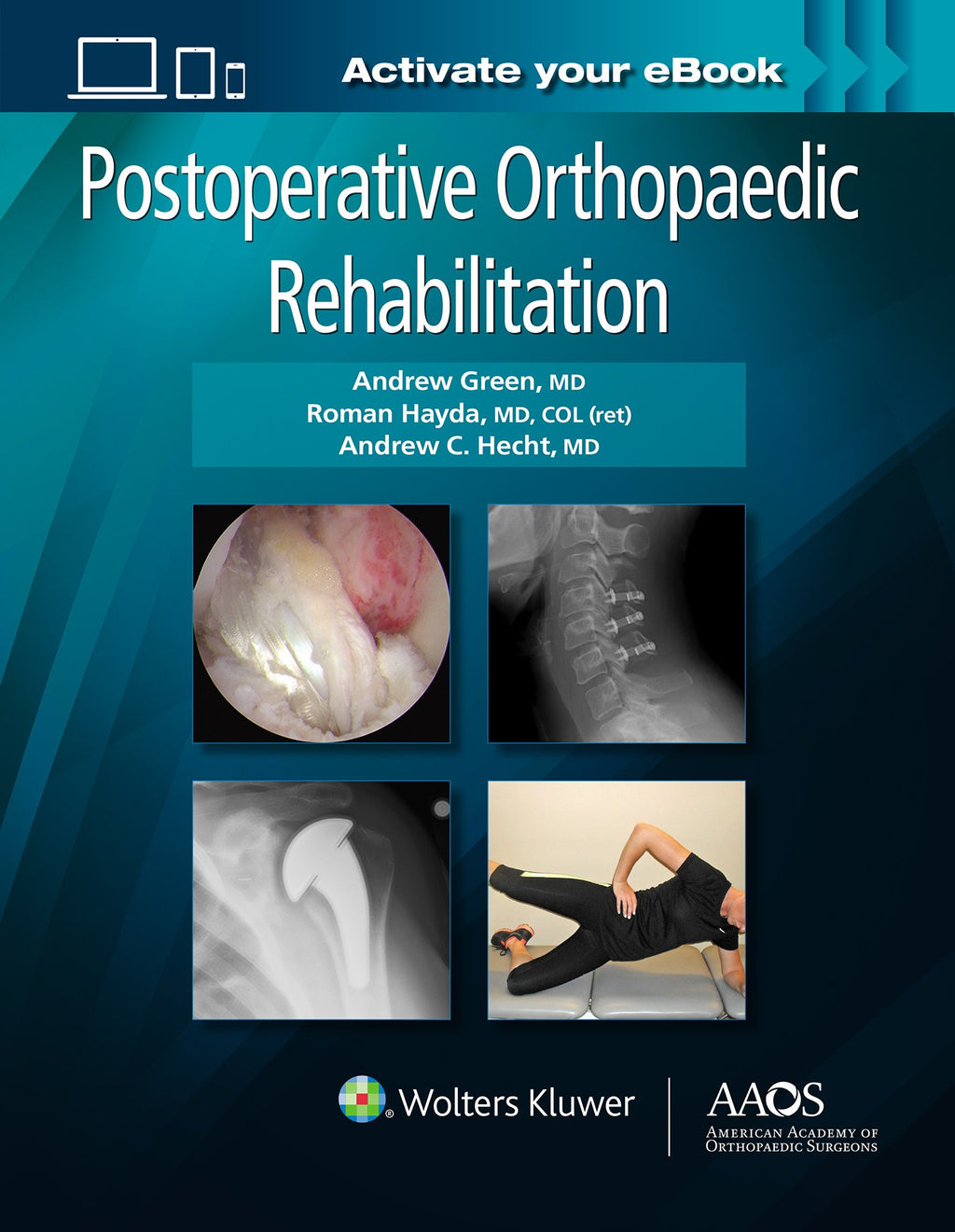 Postoperative Orthopaedic Rehabilitation: Print + Ebook (AAOS - American Academy of Orthopaedic Surgeons)