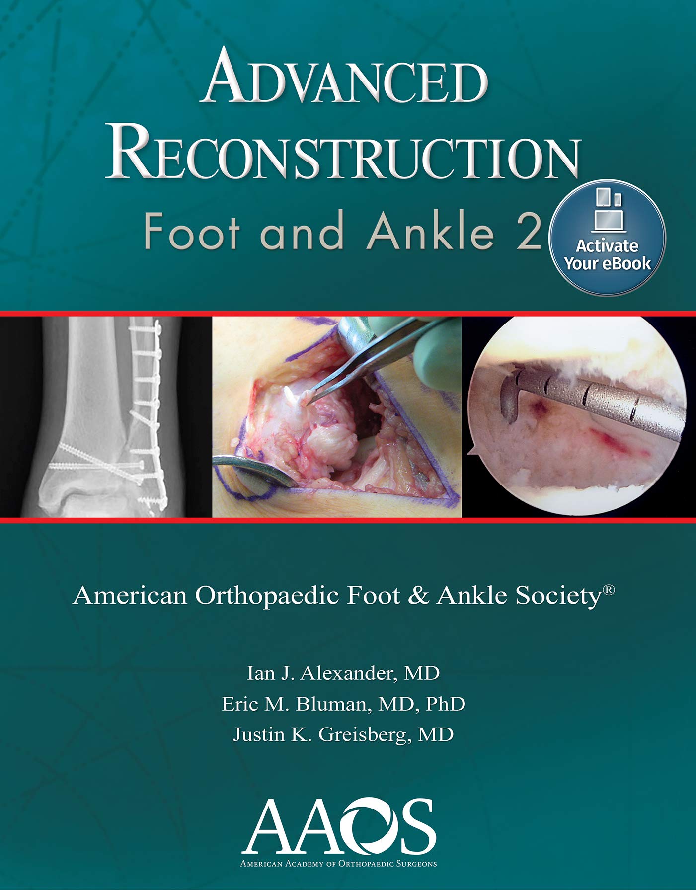 Advanced Reconstruction: Foot and Ankle 2: Print + Ebook (AAOS - American Academy of Orthopaedic Surgeons)