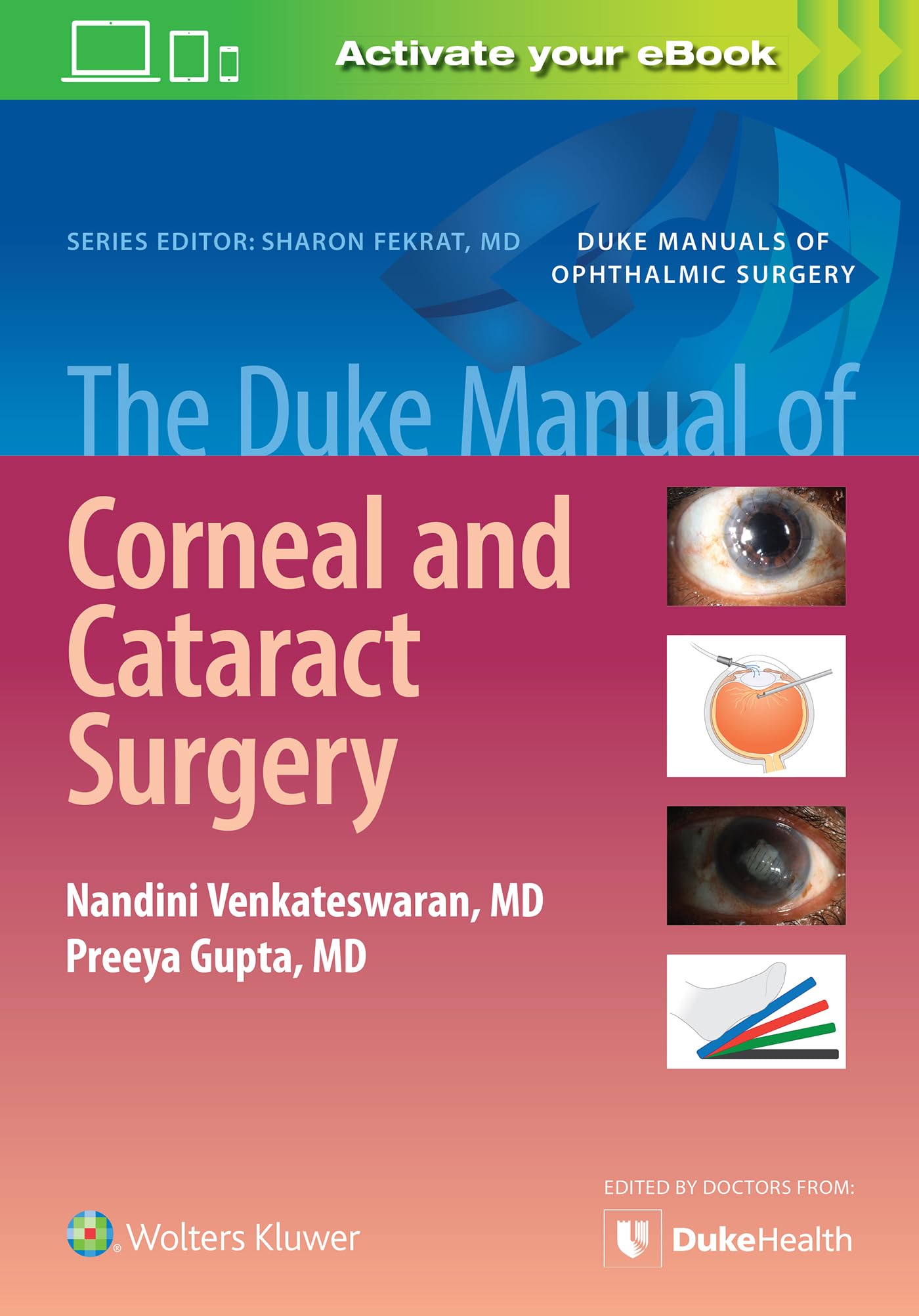 The Duke Manual of Corneal and Cataract Surgery (Duke Manuals of Ophthalmic Surgery)