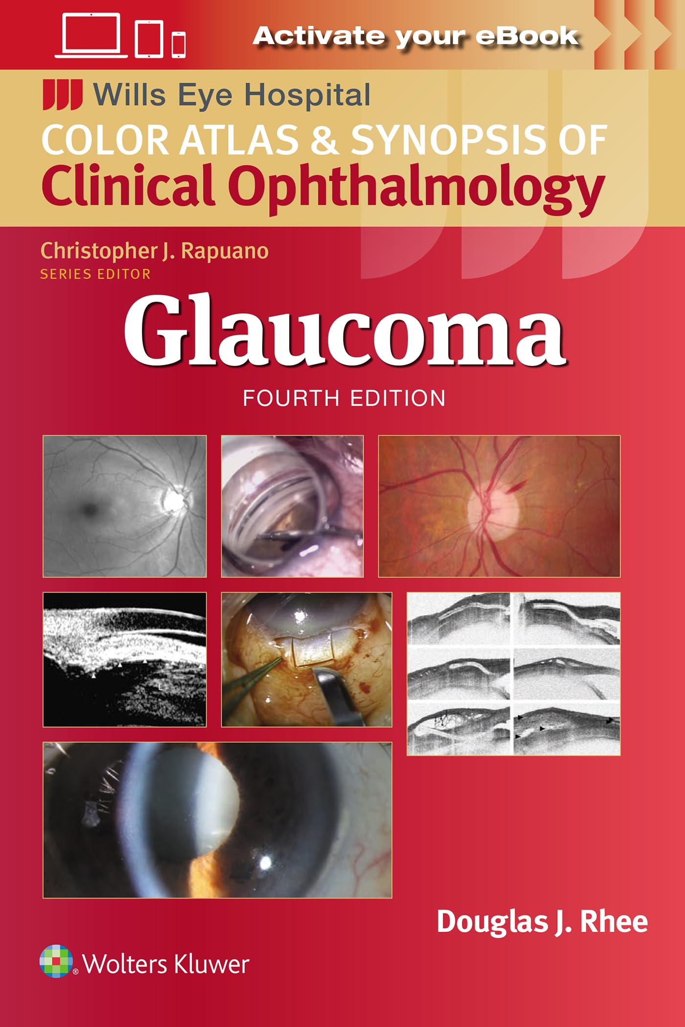 Glaucoma (Wills Eye Institute Atlas Series)