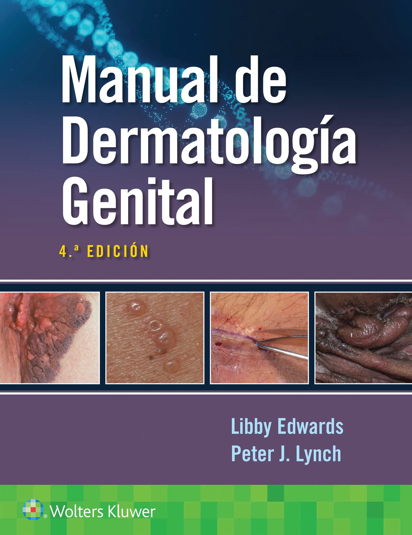 Manual de dermatología genital (Spanish Edition)