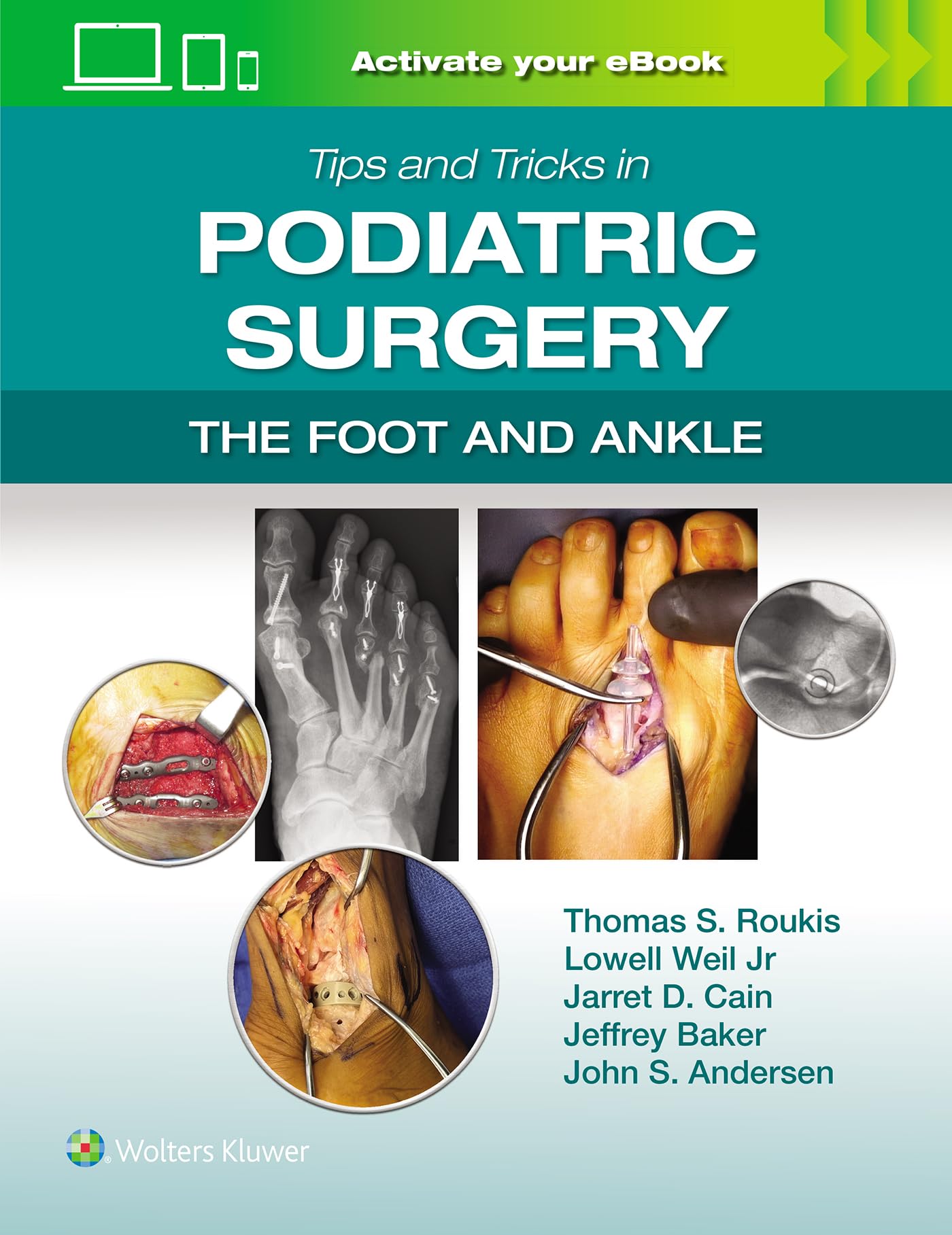 Tips and Tricks in Podiatric Surgery: The Foot and Ankle: Print + eBook with Multimedia