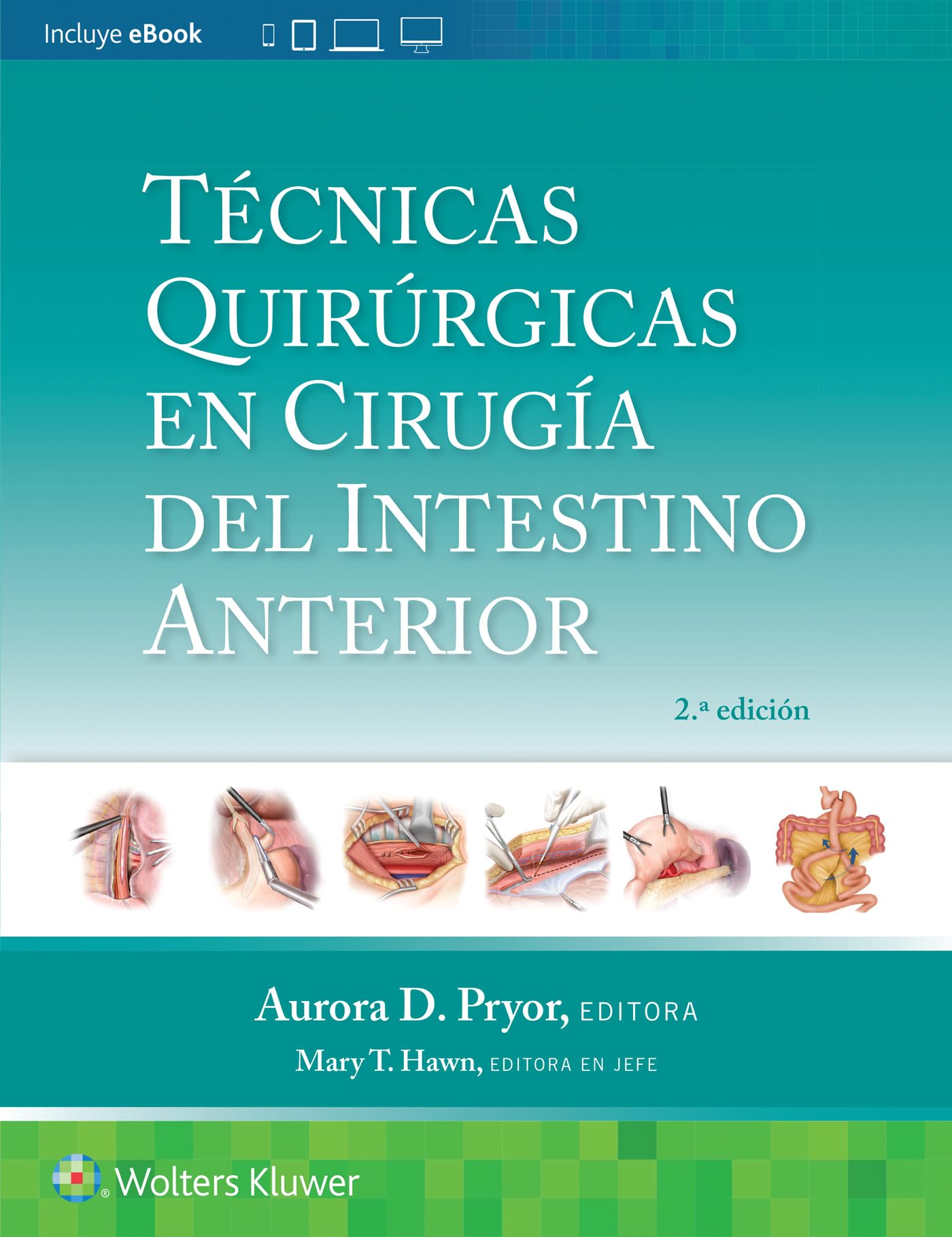 Técnicas quirúrgicas en cirugía del intestino anterior (Spanish Edition)