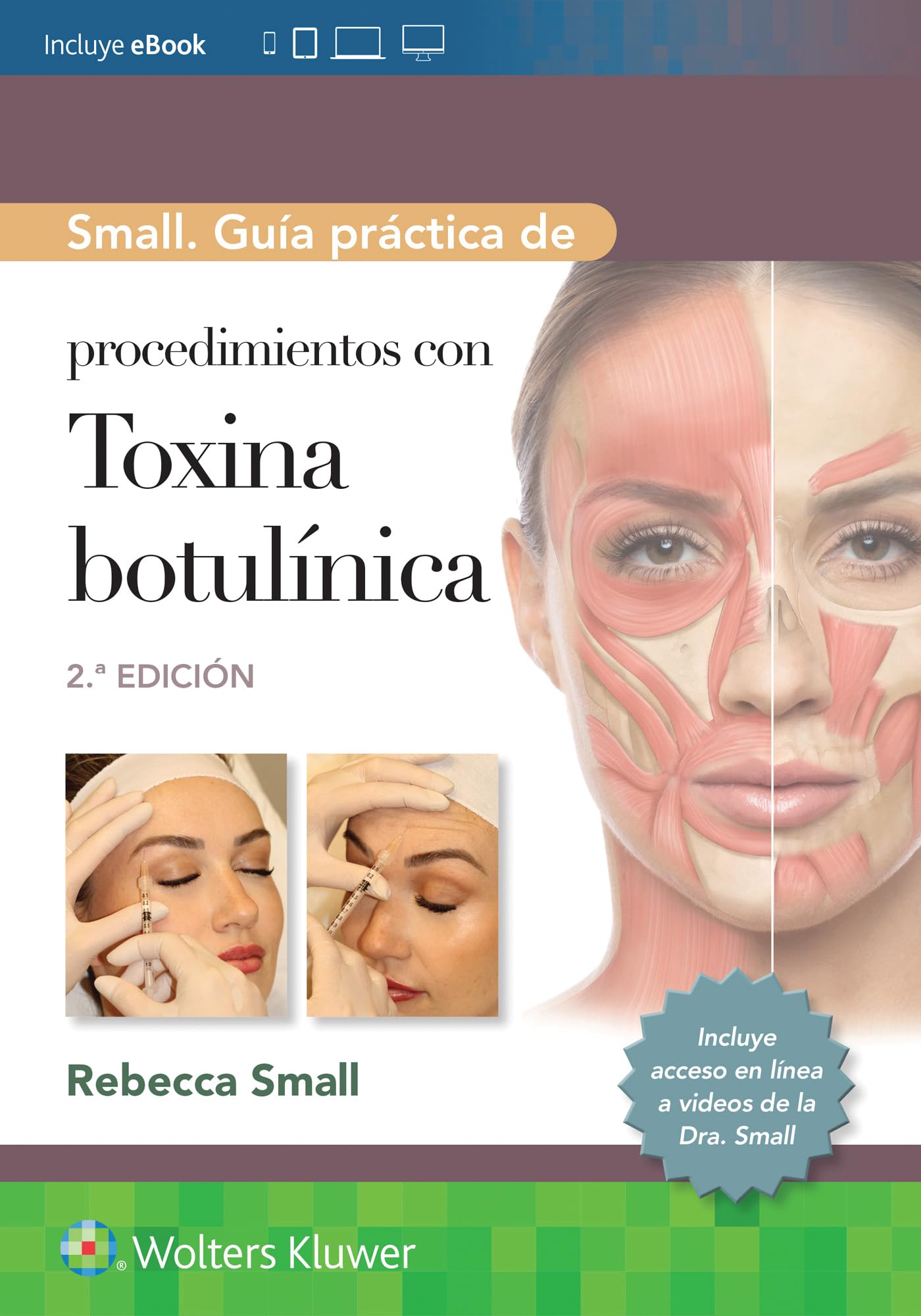 Small. Guía práctica de procedimientos con toxina botulínica (Spanish Edition)