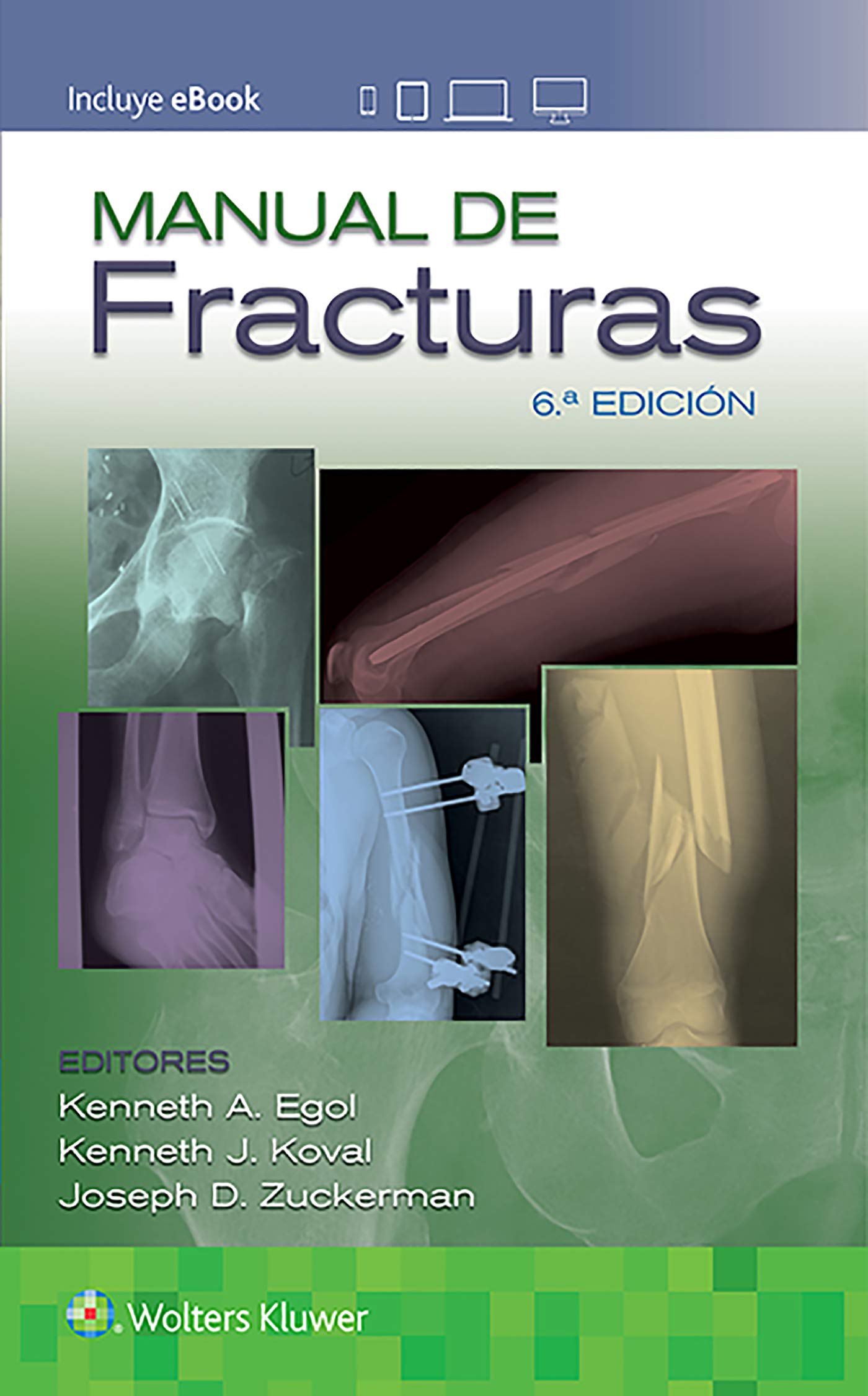 Manual de fracturas (Spanish Edition)