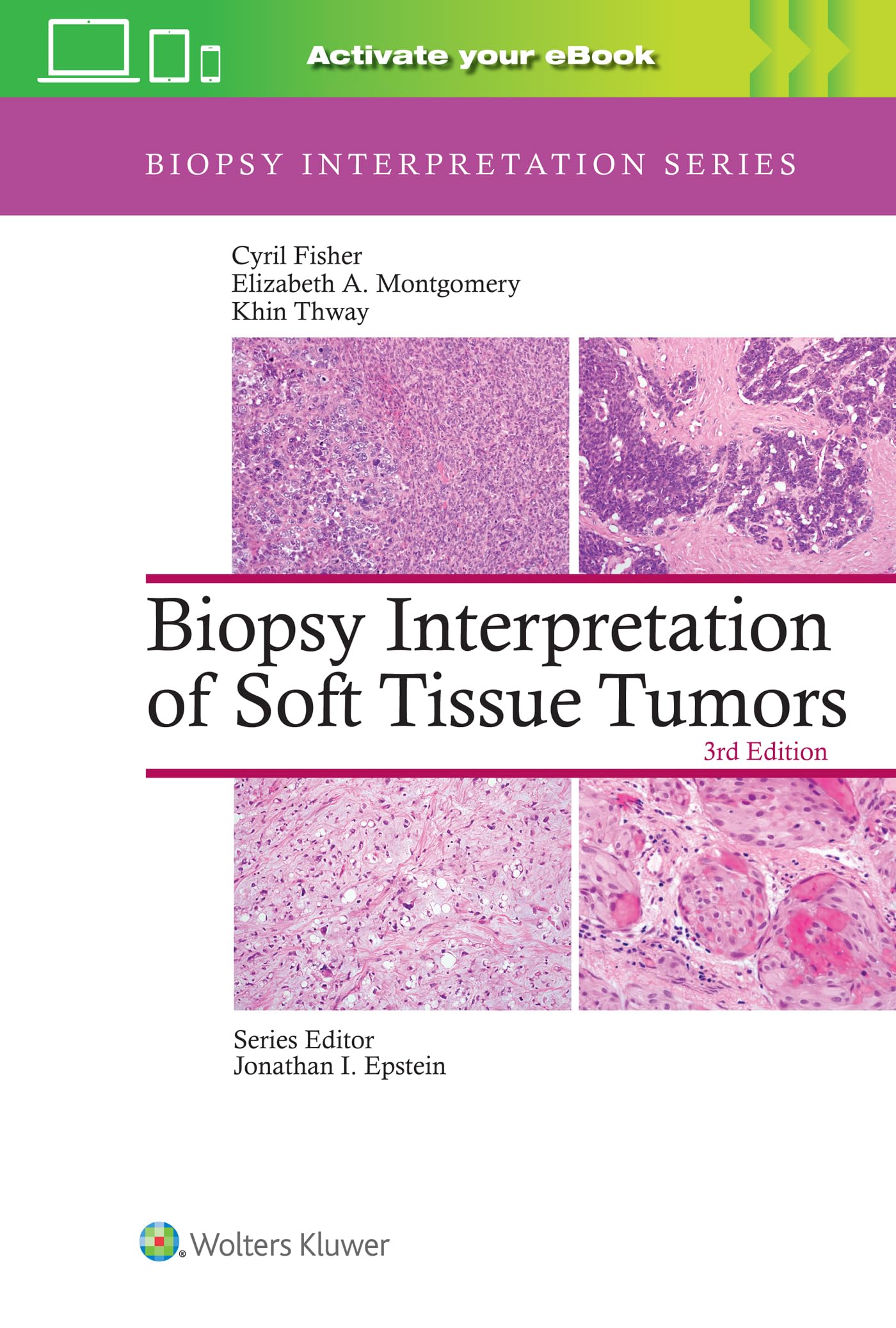 Biopsy Interpretation of Soft Tissue Tumors: Print + eBook with Multimedia (Biopsy Interpretation Series)