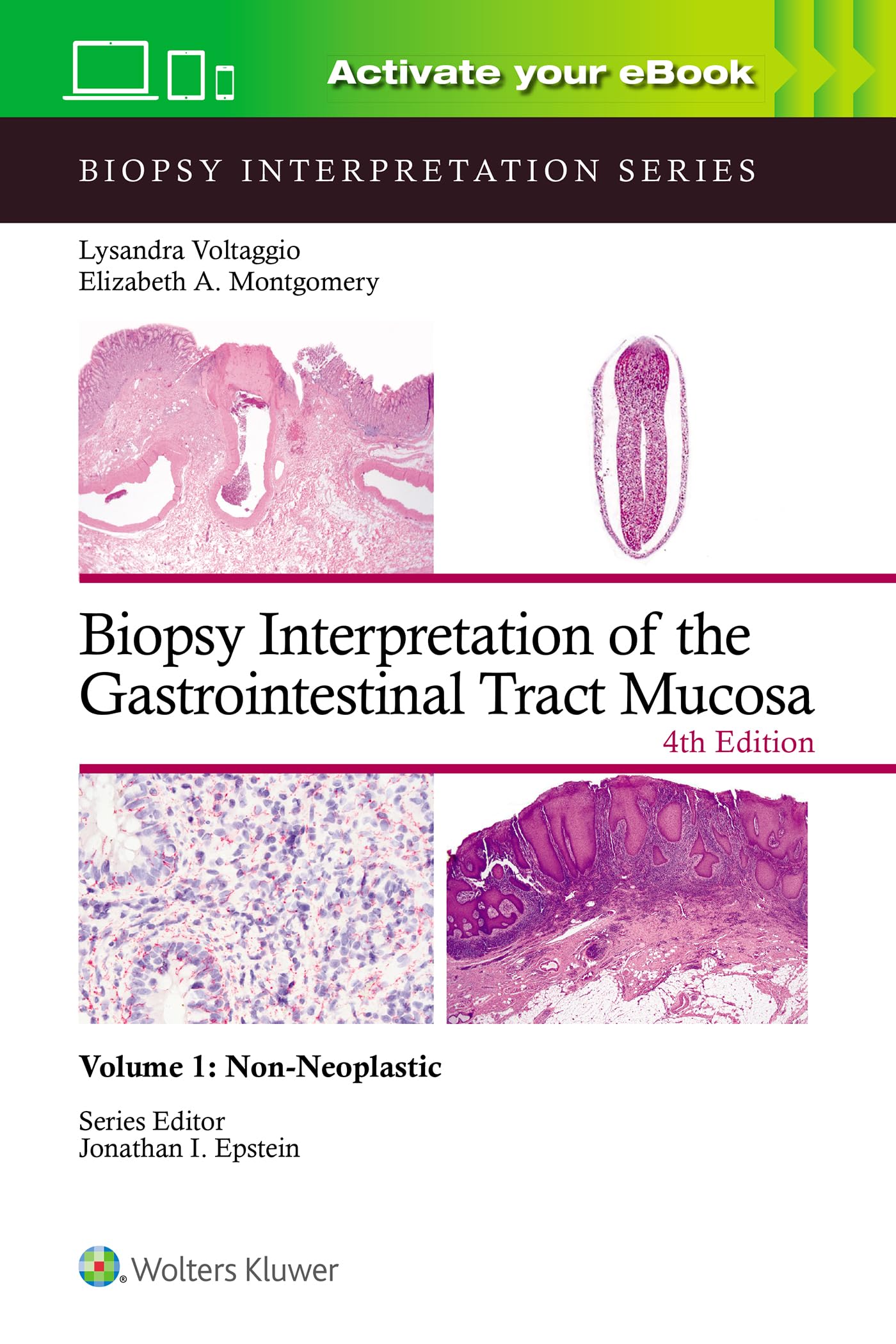 Biopsy Interpretation of the Gastrointestinal Tract Mucosa Volume 1: Non-Neoplastic: Print + eBook with Multimedia (Volume 1)