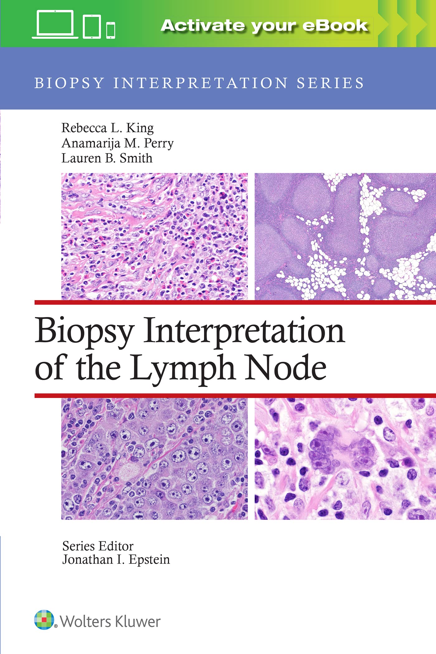 Biopsy Interpretation of the Lymph Node: Print + eBook with Multimedia