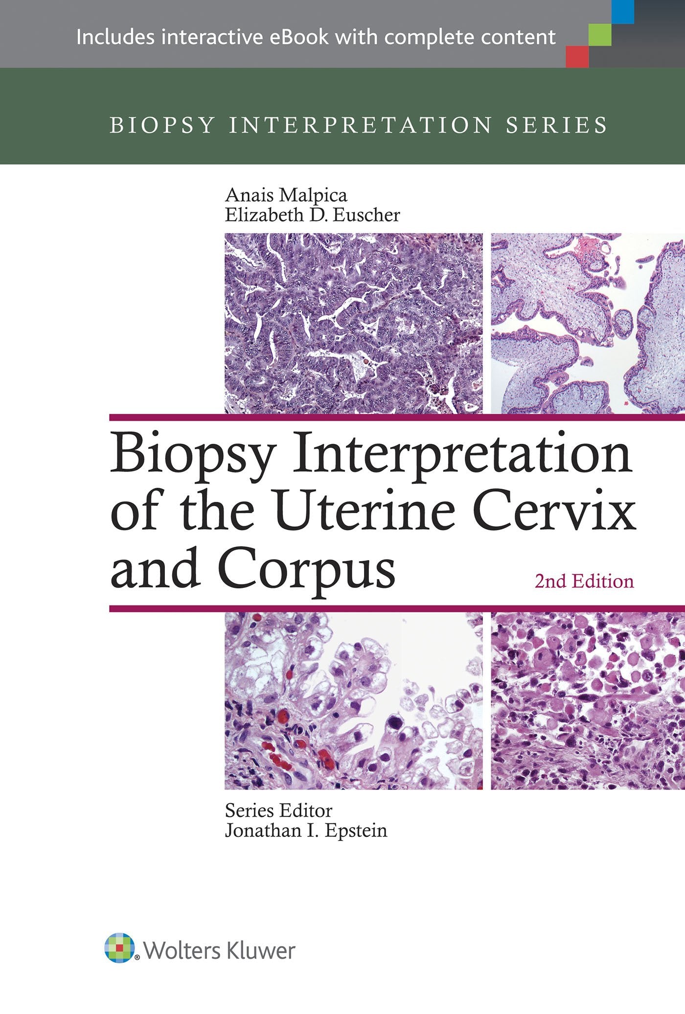 Biopsy Interpretation of the Uterine Cervix and Corpus (Biopsy Interpretation Series)