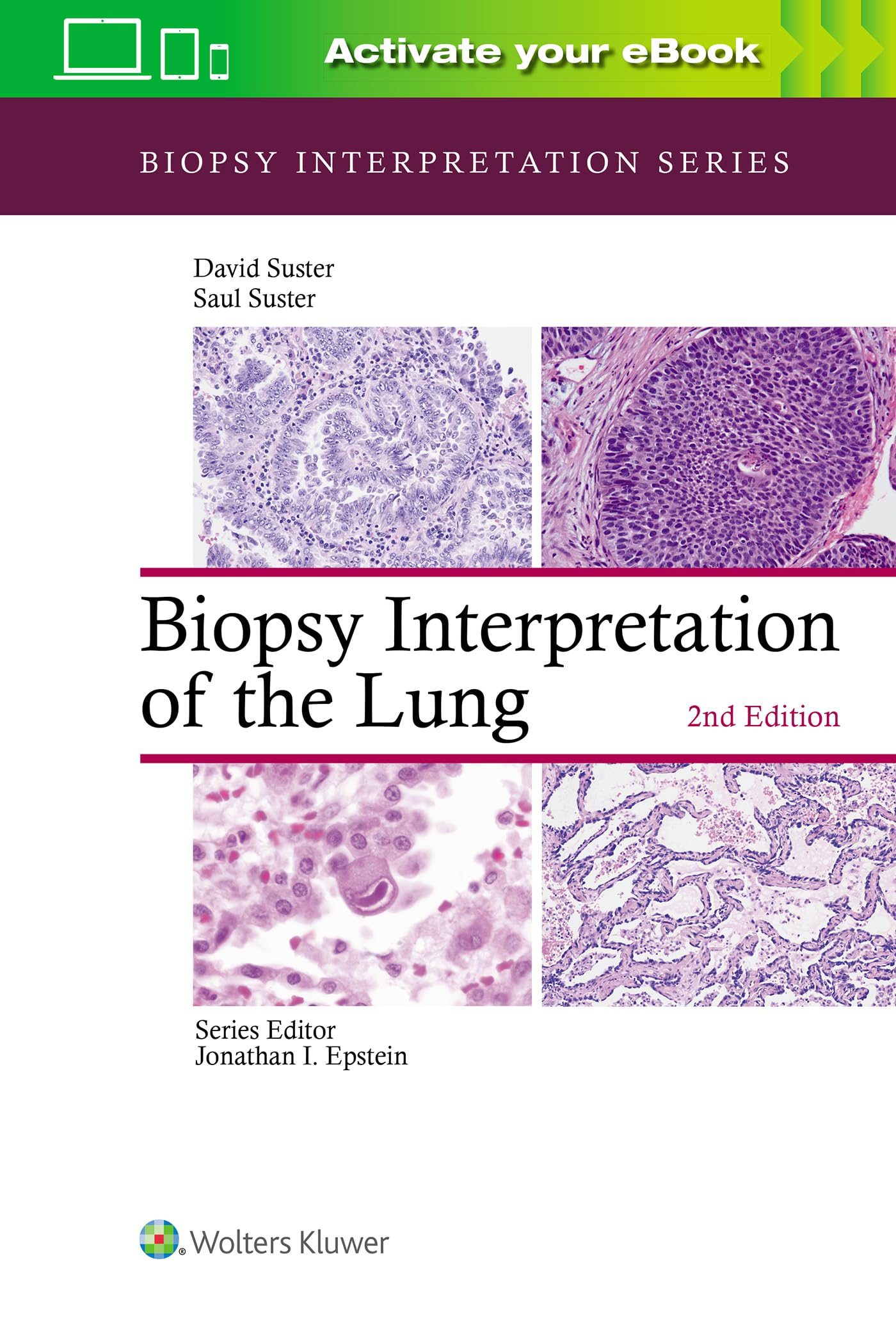 Biopsy Interpretation of the Lung (Biopsy Interpretation Series)