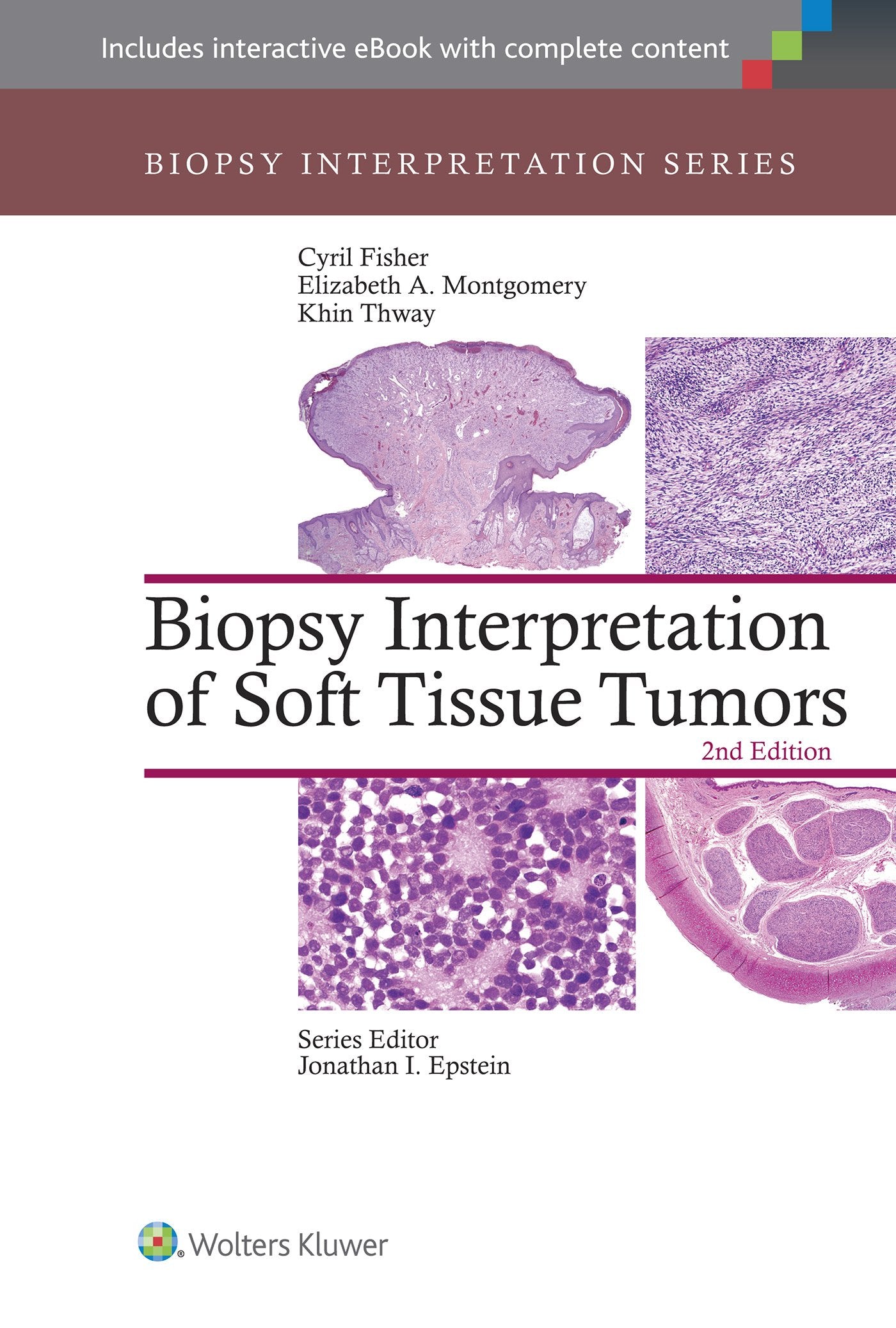 Biopsy Interpretation of Soft Tissue Tumors (Biopsy Interpretation Series)
