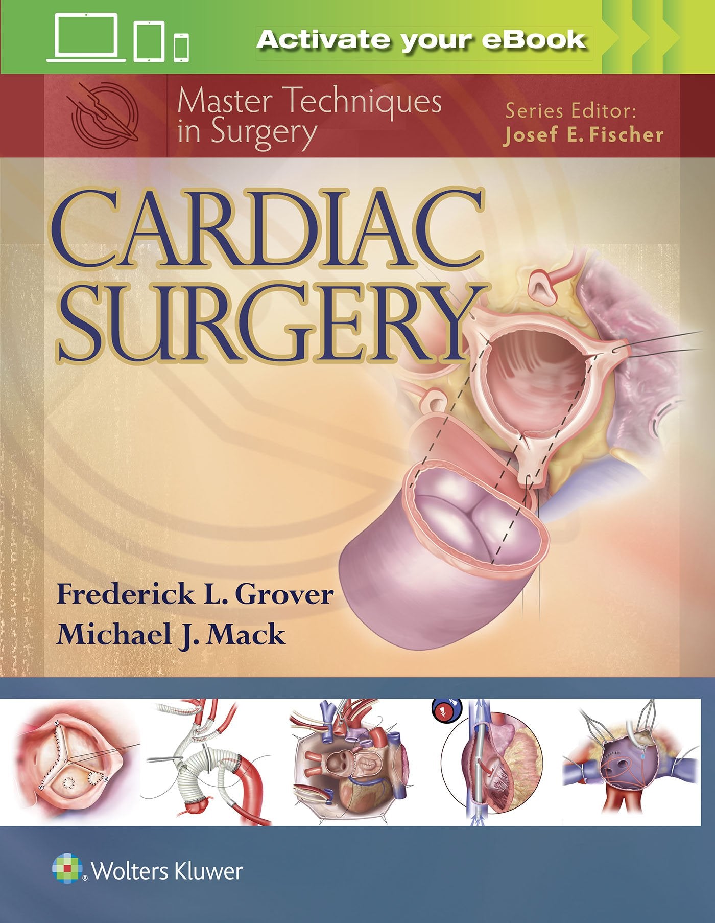 Cardiac Surgery (Master Techniques in Surgery)