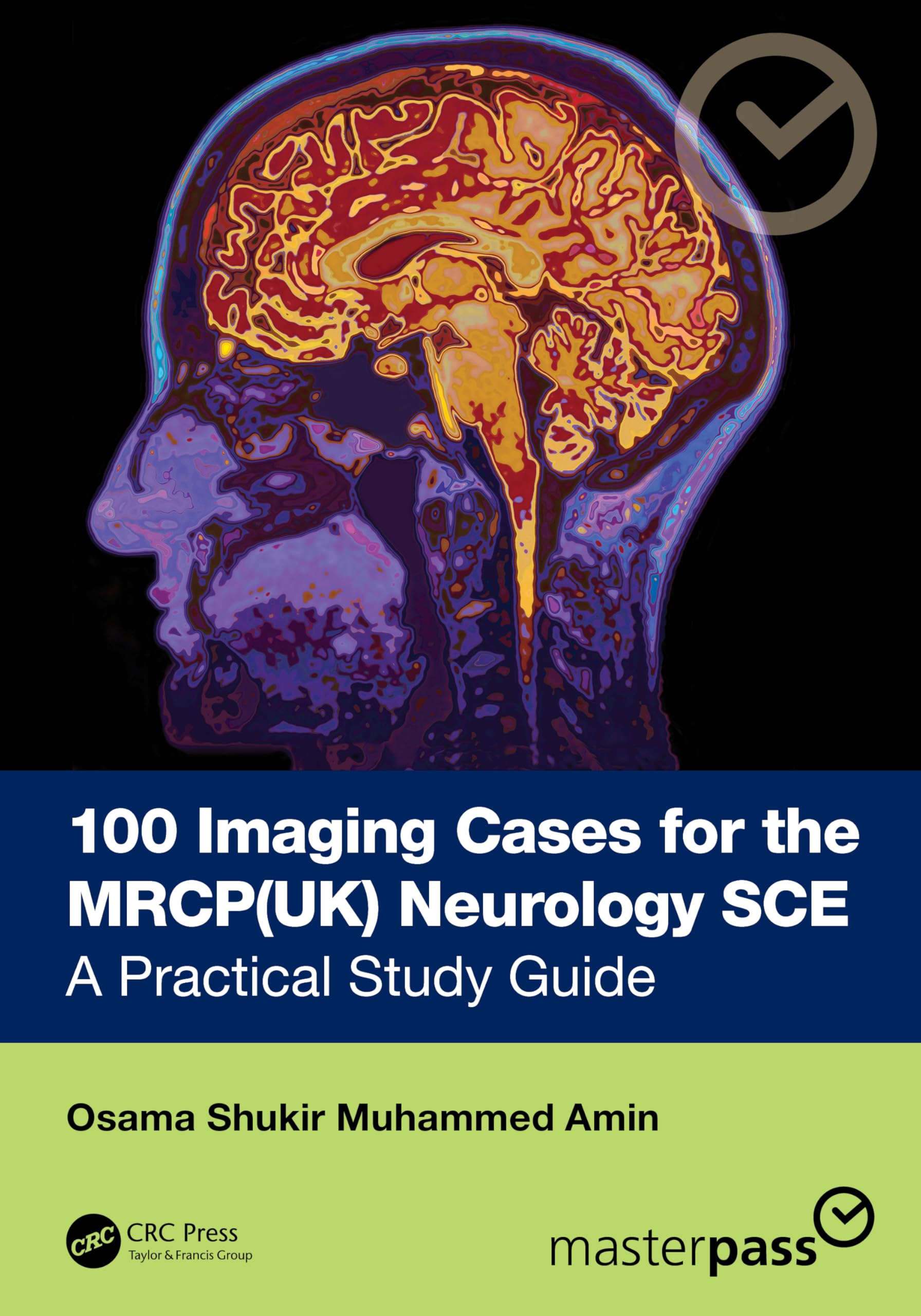 100 Imaging Cases for the MRCP Specialty Certificate Examination in Neurology: A Practical Study Guide (MasterPass)