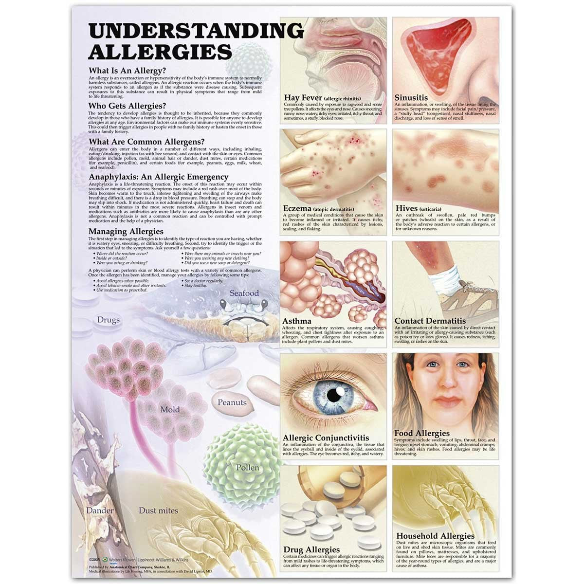 Understanding Allergies Anatomical Chart