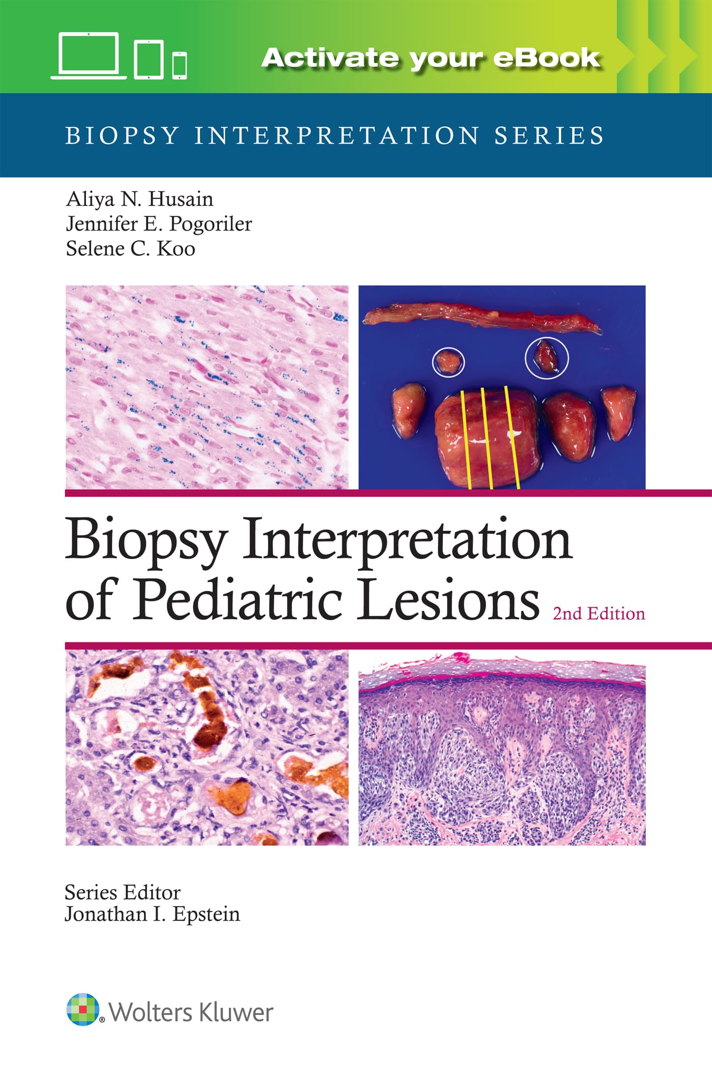 Biopsy Interpretation of Pediatric Lesions: Print + eBook with Multimedia (Biopsy Interpretation Series)