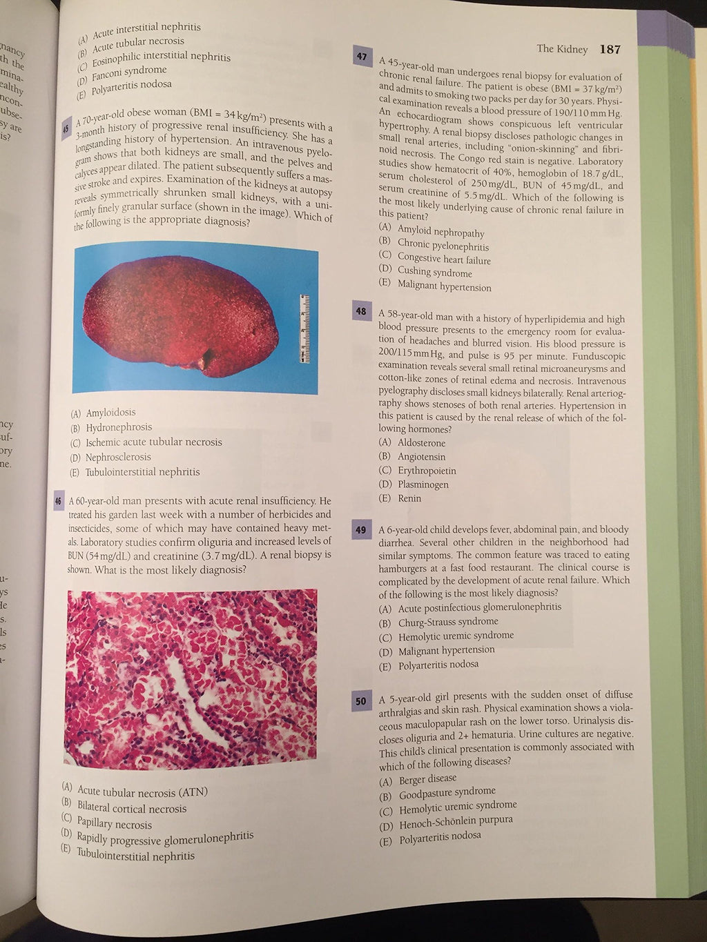 Lippincott's Illustrated Q&A Review of Rubin's Pathology, 2nd edition